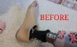 Comment mettre un nouveau pied sur votre prothèse. 