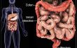 DCI : La Cure de Crohn et la colite ulcéreuse