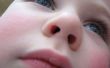 Suppression d’objet coincé dans le nez de l’enfant à vide