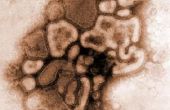 Comment éviter les Virus A H1N1