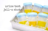 Photos de Jell-o-test urine