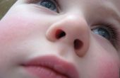 Suppression d’objet coincé dans le nez de l’enfant à vide