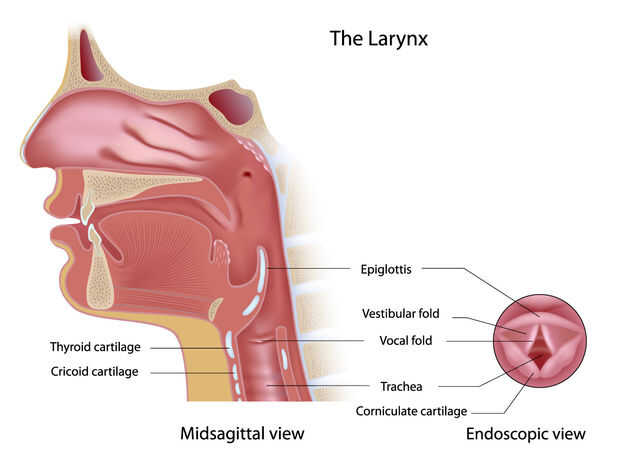 Laryngite soigner